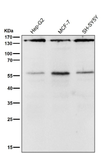 Western blot testing of human samples using the ROCK1 antibody at 1:2000 dilution for 1 hour at room temperature. A predominant band is detected at an approximately 158 kDa in all samples, consistent with full length ROCK1. An additional weaker band is observed just above the 55 kDa marker, which likely represents a proteolytic fragment of ROCK1 generated during cell stress or sample preparation rather than a distinct isoform.