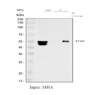 Immunoprecipitating PD-ECGF/TYMP in SiHa whole cell lysate. Western blot analysis of PD-ECGF/TYMP using anti-TYMP antibody. Lane 1: SiHa whole cell lysates (30ug), Lane 2: Rabbit control IgG instead of anti-TYMP antibody in SiHa whole cell lysate, Lane 3: anti-TYMP antibody (2ug) + SiHa whole cell lysate (500ug). After electrophoresis, proteins were transferred to a membrane. Then the membrane was incubated with rabbit anti-TYMP antibody at a dilution of 0.5 ug/ml and probed with a goat anti-rabbit IgG-HRP secondary antibody. The signal is developed using ECL Plus Western Blotting Substrate. The input lane shows the characteristic doublet at approximately 50 kDa and in the high 40 kDa region. In contrast, the immunoprecipitated material displays a single band at approximately 50 kDa, indicating selective enrichment of the full length TYMP species. The control IgG lane shows no detectable signal, confirming specificity of the immunoprecipitation.