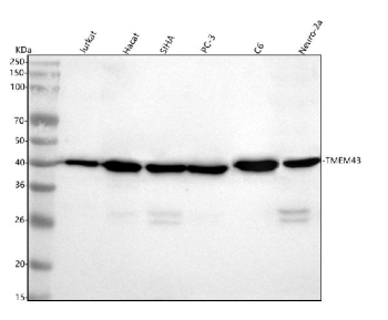 Western blot analysis of TMEM43 using anti-TMEM43 antibody. Lane 1: human Jurkat whole cell lysates, Lane 2: human Hacat whole cell lysates, Lane 3: human SiHa whole cell lysates, Lane 4: human PC-3 whole cell lysates, Lane 5: rat C6 whole cell lysates, Lane 6: mouse Neuro-2a whole cell lysates. After electrophoresis, proteins were transferred to a nitrocellulose membrane at 150 mA for 50-90 minutes. Blocked the membrane with 5% non-fat milk/TBS for 1.5 hour at RT. The membrane was incubated with rabbit anti-TMEM43 antibody at 1:500 overnight at 4oC, then washed with TBS-0.1%Tween 3 times with 5 minutes each and probed with a goat anti-rabbit IgG-HRP secondary antibody at a dilution of 1:1000 for 1.5 hour at RT. The signal was developed using enhanced chemiluminescent. A predominant band is detected at an approximately 40 kDa in all samples, slightly below the predicted ~45 kDa size but consistent with the apparent molecular weight typically observed for the integral membrane protein TMEM43 under denaturing conditions.