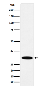 Western blot analysis of HMGCL expression in human A431 cell lysate using HMGCL antibody. Predicted molecular weight ~34 kDa.