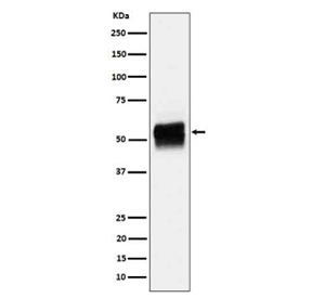 Western blot analysis of Phospho-Tau (S202) expression in mouse hippocampus cell lysate using Phospho-Tau (Ser202) antibody. The expected molecular weight of phosphorylated Tau (Ser202) is approximately 45-70 kDa, corresponding to the major Tau isoforms.
