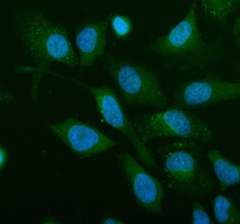 Immunofluorescent staining of Renin receptor/ATP6AP2 using anti-Renin receptor antibody (green). Renin receptor/ATP6AP2 was detected in an immunocytochemical section of human HeLa cells. Enzyme antigen retrieval was performed using IHC enzyme antigen retrieval reagent for 15 mins. The cells were blocked with 10% goat serum. And then incubated with 5 ug/ml rabbit anti-Renin receptor antibody overnight at 4oC. DyLight 488 Conjugated Goat Anti-Rabbit IgG was used as secondary antibody at 1:500 dilution and incubated for 30 minutes at 37oC. The section was counterstained with DAPI nuclear stain (blue). Visualize using a fluorescence microscope and filter sets appropriate for the label used.