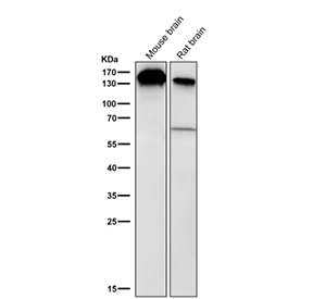 Western blot testing of mouse and rat brain tissue lysate using the BCLAF1 antibody at 1:2000 dilution for 1 hour at room temperature. A predominant band is detected at approximately 150 kDa in both samples, running above the predicted ~106 kDa but consistent with the apparent molecular weight reported for the heavily modified nuclear protein BCLAF1 in peer reviewed studies.