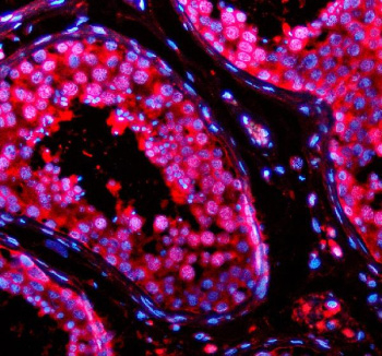 Immunofluorescent staining of TSN using anti-Translin antibody (red). TSN was detected in a paraffin-embedded section of human testis tissue. Heat mediated antigen retrieval was performed in EDTA buffer (pH 8.0, epitope retrieval solution). The tissue section was blocked with 10% goat serum. The tissue section was then incubated with 5 ug/ml rabbit anti-Translin antibody overnight at 4oC. Cy3 Conjugated Goat Anti-Rabbit IgG was used as secondary antibody at 1:500 dilution and incubated for 30 minutes at 37oC. The section was counterstained with DAPI nuclear stain (blue). Visualize using a fluorescence microscope and filter sets appropriate for the label used.