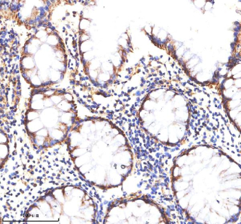 Immunohistochemical staining of MATK using anti-MATK antibody. MATK was detected in a paraffin-embedded section of human colon tissue. Heat mediated antigen retrieval was performed in EDTA buffer (pH 8.0, epitope retrieval solution). The tissue section was blocked with 10% goat serum. The tissue section was then incubated with 2 ug/ml rabbit anti-MATK antibody overnight at 4oC. Peroxidase Conjugated Goat Anti-rabbit IgG was used as secondary antibody and incubated for 30 minutes at 37oC. The tissue section was developed using an HRP secondary and DAB substrate.
