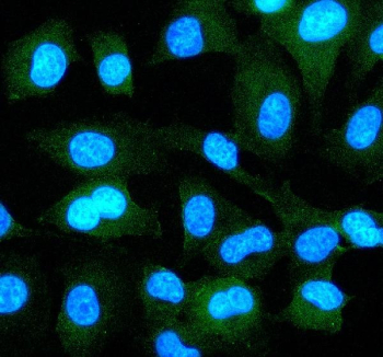 Immunofluorescent staining of EPS8 using anti-EPS8 antibody (green). EPS8 was detected in an immunocytochemical section of cells. Enzyme antigen retrieval was performed using IHC enzyme antigen retrieval reagent for 15 mins. The cells were blocked with 10% goat serum. And then incubated with 5 ug/ml rabbit anti-EPS8 antibody overnight at 4oC. DyLight 488 Conjugated Goat Anti-Rabbit IgG was used as secondary antibody at 1:500 dilution and incubated for 30 minutes at 37oC. The section was counterstained with DAPI nuclear stain (blue). Visualize using a fluorescence microscope and filter sets appropriate for the label used.