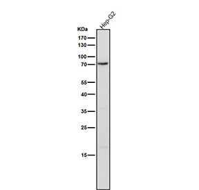 Western blot testing of huma HepG2 cell lysate using the Phospho-PKC delta (Tyr311) antibody at 1:1000 dilution for 1 hour at room temperature. Predicted molecular weight ~75 kDa.