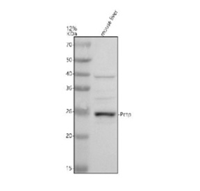 Western blot analysis of PCTP using anti-PCTP antibody. Electrophoresis was performed on a 12% SDS-PAGE gel at 80V (Stacking gel) / 120V (Resolving gel) for 2 hours. Lane 1: mouse liver tissue lysates. After electrophoresis, proteins were transferred to a nitrocellulose membrane at 150 mA for 50-90 minutes. Blocked the membrane with 5% non-fat milk/TBS for 1.5 hour at RT. The membrane was incubated with rabbit anti-PCTP antibody at 0.5 ug/ml overnight at 4oC, then washed with TBS-0.1%Tween 3 times with 5 minutes each and probed with a goat anti-rabbit IgG-HRP secondary antibody at a dilution of 1:5000 for 1.5 hour at RT. The signal was developed using an ECL Plus Western Blotting Substrate. The expected molecular weight of PCTP is ~25 kDa.