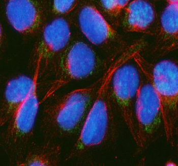 Immunofluorescent staining of BCKDH E2/DBT using anti-BCKDH E2 antibody (green) and anti-Beta Tubulin antibody (red). BCKDH E2/DBT was detected in an immunocytochemical section of U2OS cells. Enzyme antigen retrieval was performed using IHC enzyme antigen retrieval reagent for 15 mins. The cells were blocked with 10% goat serum. And then incubated with 5 ug/ml rabbit anti-BCKDH E2 antibody and mouse anti-Beta Tubulin antibody overnight at 4oC. DyLight 488 Conjugated Goat Anti-Rabbit IgG and DyLight 550 Conjugated Goat Anti-Mouse IgG were used as secondary antibody at 1:500 dilution and incubated for 30 minutes at 37oC. The section was counterstained with DAPI nuclear stain (blue). Visualize using a fluorescence microscope and filter sets appropriate for the label used.