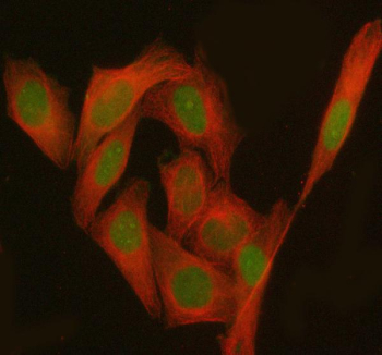 Immunofluorescent staining of PHF17/JADE1 using anti-JADE1 antibody (green) and anti-Beta Tubulin antibody (red). JADE1 was detected in immunocytochemical section of human HeLa cells. Enzyme antigen retrieval was performed using IHC enzyme antigen retrieval reagent for 15 mins. The cells were blocked with 10% goat serum. And then incubated with 5 ug/ml rabbit anti-JADE1 antibody and mouse anti-Beta Tubulin antibody overnight at 4oC. DyLight 488 Conjugated Goat Anti-Rabbit IgG and Cy3 Conjugated Goat Anti-Mouse IgG were used as secondary antibody at 1:500 dilution and incubated for 30 minutes at 37oC. Visualize using a fluorescence microscope and filter sets appropriate for the label used.