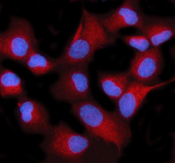 Immunofluorescent staining of STIM2 using anti-STIM2 antibody (red). STIM2 was detected in an immunocytochemical section of human HeLa cells. Enzyme antigen retrieval was performed using IHC enzyme antigen retrieval reagent for 15 mins. The cells were blocked with 10% goat serum. And then incubated with 5 ug/ml rabbit anti-STIM2 antibody overnight at 4oC. Cy3 Conjugated Goat Anti-Rabbit IgG was used as secondary antibody at 1:500 dilution and incubated for 30 minutes at 37oC. The section was counterstained with DAPI nuclear stain (blue). Visualize using a fluorescence microscope and filter sets appropriate for the label used.
