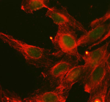 Immunofluorescent staining of FFPE human U-2 OS cells with c-Maf antibody (green) and Alpha Tubulin mAb (red). HIER: steam section in pH6 citrate buffer for 20 min.