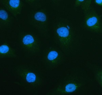 Immunofluorescent staining of FFPE human a549 cells with ACOX1 antibody (green) and Alpha Tubulin mAb (red). HIER: steam section in pH6 citrate buffer for 20 min.