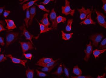 Immunofluorescent staining of FFPE human HeLa cells with SLC25A1 antibody (red) and DAPI nuclear stain (blue). HIER: steam section in pH6 citrate buffer for 20 min.