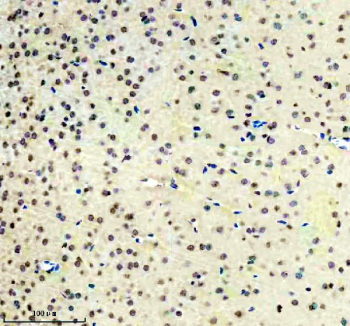 Immunohistochemical staining of FFPE mouse brain tissue with Islet 1 antibody, HRP-secondary and DAB substrate. HIER: boil tissue sections in pH8 EDTA for 20 min and allow to cool before testing.