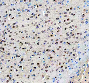 Immunohistochemical staining of FFPE mouse brain tissue with AGO3 antibody, HRP-secondary and DAB substrate. HIER: boil tissue sections in pH8 EDTA for 20 min and allow to cool before testing.