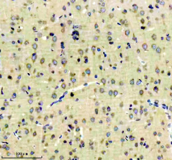 Immunohistochemical staining of FFPE rat brain tissue with EEA1 antibody, HRP-secondary and DAB substrate. HIER: boil tissue sections in pH8 EDTA for 20 min and allow to cool before testing.