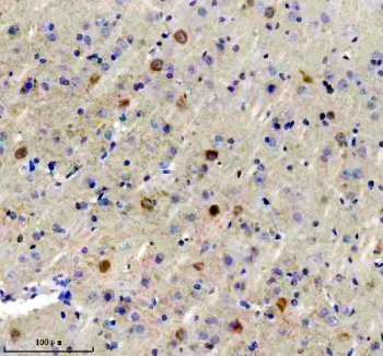 Immunohistochemical staining of FFPE pig brain tissue with Glutamate decarboxylase 1 antibody, HRP-secondary and DAB substrate. HIER: boil tissue sections in pH8 EDTA for 20 min and allow to cool before testing.