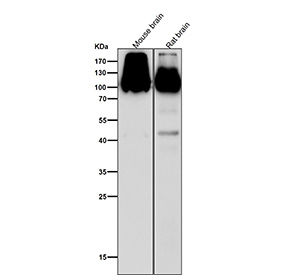 Western blot analysis of GluR2/GluR3 (GRIA2/GRIA3) expression in mouse brain and rat brain lysates using GluR2/GluR3 antibody. A predominant band is detected at approximately 99 kDa, consistent with GluR2 and GluR3. Additional higher molecular weight bands are observed around 130 kDa and above 170 kDa, which may reflect glycosylated and/or complex-associated receptor forms. A weaker lower band of approximately 45 kDa is observed in rat brain, which may represent a fragment.