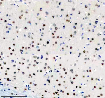 Immunohistochemical analysis of BIRC2 using anti-BIRC2 antibody. BIRC2 is detected in a paraffin-embedded section of rat brain tissue following heat-mediated antigen retrieval in EDTA buffer (pH 8.0). Positive staining is observed in a subset of brain cells, consistent with reported BIRC2 expression patterns.