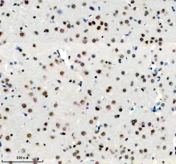 Immunohistochemical staining of FFPE rat brain tissue with DDX17 antibody, HRP-secondary and DAB substrate. HIER: boil tissue sections in pH8 EDTA for 20 min and allow to cool before testing.