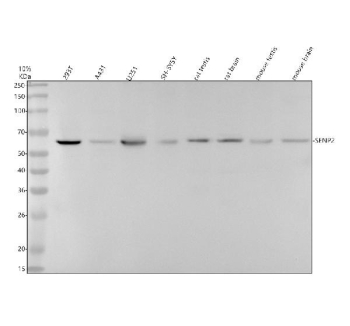 Western blot testing of 1) human A549, 2) human HepG2, 3) rat kidney and 4) mouse kidney tissue lysate with AKR1C3 antibody. Predicted molecular weight ~37 kDa.