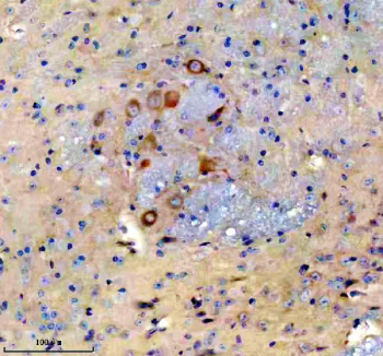 Immunohistochemical staining of FFPE mouse brain tissue with NCR2 antibody, HRP-secondary and DAB substrate. HIER: boil tissue sections in pH8 EDTA for 20 min and allow to cool before testing.
