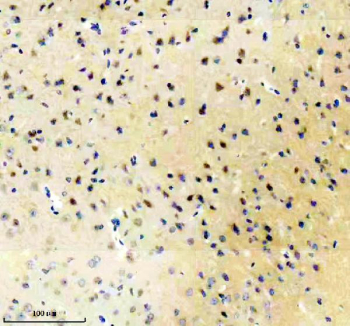 Immunohistochemical analysis of GRM1 using anti-GRM1 antibody. GRM1 is detected in a paraffin-embedded section of mouse brain tissue following heat-mediated antigen retrieval. Cell-associated staining is observed in neuronal populations and surrounding neuropil, consistent with reported expression patterns of Metabotropic glutamate receptor 1 in the brain.