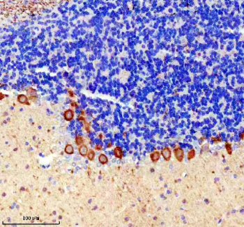 Immunohistochemical staining of rat cerebellum using PRKCG antibody, HRP-secondary and DAB substrate. HIER: boil tissue sections in pH8 EDTA for 20 min and allow to cool before testing. Protein kinase C gamma shows strong cytoplasmic staining in Purkinje neurons localized to the Purkinje cell layer, with minimal staining in the surrounding granular layer.
