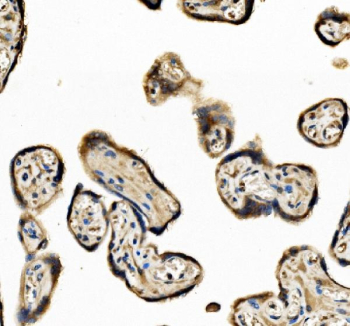 Immunohistochemical staining using EIF3D antibody on paraffin-embedded human placenta tissue sections. Heat-induced epitope retrieval was performed using EDTA buffer (pH 8.0) prior to antibody incubation. Sections were blocked and incubated with EIF3D antibody overnight at 4C. Detection was carried out using an HRP-based secondary antibody with DAB as the chromogen. Staining demonstrates cytoplasmic immunoreactivity in placental tissue. Nuclei were counterstained with hematoxylin.