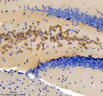 Immunohistochemical staining using DKK3 antibody on paraffin-embedded mouse brain tissue sections. Heat-induced epitope retrieval was performed using EDTA buffer (pH 8.0) prior to antibody incubation. Sections were blocked with 10% goat serum and incubated with DKK3 antibody overnight at 4C. Detection was carried out using an HRP-based secondary antibody with DAB as the chromogen. Staining demonstrates cytoplasmic immunoreactivity in brain tissue. Nuclei were counterstained with hematoxylin.