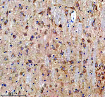 Immunohistochemistry analysis of Doublecortin-like kinase 1 using Doublecortin-like kinase 1 antibody. Doublecortin-like kinase 1 expression was examined in a paraffin-embedded section of rat brain tissue. Heat-mediated antigen retrieval was performed using EDTA buffer (pH 8.0). Tissue sections were blocked with normal goat serum and incubated with Doublecortin-like kinase 1 antibody overnight at 4Â°C. Immunoreactivity was detected using an HRP-based detection system with DAB chromogen, followed by hematoxylin counterstaining.