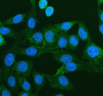 Immunofluorescence analysis of Peroxisomal biogenesis factor 16 using PEX16 antibody. PEX16 expression was examined in cultured human HeLa cells. Enzymatic antigen retrieval was performed prior to staining. Cells were blocked with normal goat serum and incubated with PEX16 antibody (green) overnight at 4C. Immunoreactivity shows a cytoplasmic staining pattern with punctate distribution consistent with peroxisomal membranes, and nuclei were counterstained with DAPI (blue).