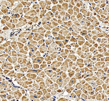 Immunohistochemistry analysis of PGAM2 using PGAM2 antibody. PGAM2 expression was examined in a paraffin-embedded section of human heart tissue, with immunoreactivity predominantly observed in cardiomyocytes, consistent with the high metabolic demand of cardiac muscle. Heat-mediated antigen retrieval was performed using EDTA buffer (pH 8.0). Tissue sections were blocked with normal goat serum and incubated with PGAM2 antibody overnight at 4Â°C. Immunoreactivity was visualized using an HRP-based detection system with DAB chromogen, followed by hematoxylin counterstaining.