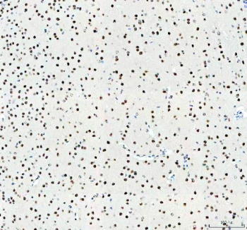 Immunohistochemistry analysis of MECP2 using Methyl-CpG-binding protein 2 antibody. MECP2 expression was examined in mouse brain tissue, with prominent nuclear staining observed in neuronal cells throughout the cortex. Heat-mediated antigen retrieval was performed using EDTA buffer (pH 8.0). Tissue sections were blocked with normal goat serum and incubated with MECP2 antibody overnight at 4Â°C. Immunoreactivity was visualized using an HRP-based detection system with DAB chromogen, followed by hematoxylin counterstaining.