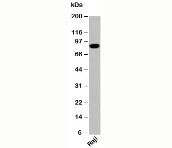 IKKb antibody western blot of human samples