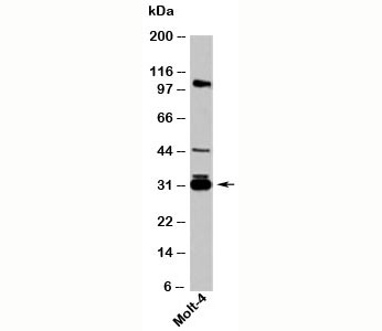 Western blot testing of human samples with 14-3-3 sigma antibody at 1ug/ml. Predicted molecular weight: ~28kDa.