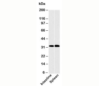 CLEC1 antibody western blot of human samples