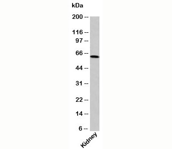 OTUD5 antibody western blot of human samples