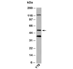 TXNIP antibody western blot of human samples