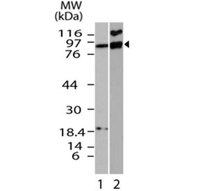 Western blot testing of mouse 1) kidney and 2) EL4 lysate with IFI204 antibody at 3ug/ml.