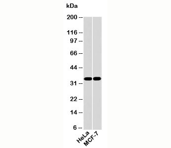 Western blot testing of human samples with EMAP II antibody at 2ug/ml. Predicted molecular weight: ~34/37kDa (isoforms 1/2).