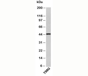 CRHR2 antibody western blot of human samples