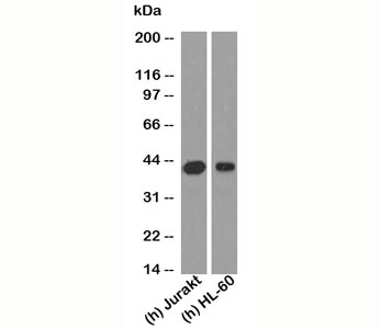 RUNX3 antibody western blot of human samples. Predicted molecular weight: ~44 kDa, isoforms can be observed at 42-48 kDa.