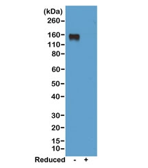 Western blot of nonreduced(-) and reduced(+) mouse IgG2a, using 0.5ug/ml of recombinant Mouse IgG2a antibody. This mAb reacts to nonreduced IgG2a (~150 kDa).