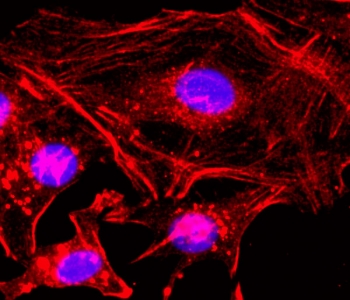 ICC staining of human HeLa cells using the recombinant Beta Actin antibody at 1:200 (red) and DAPI to stain the nuclei (blue).