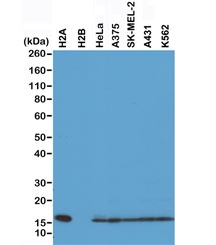 Western blot of recombinant Histone H2A protein, H2B protein and whole cell lysates of human HeLa, A375, SK-MEL-2, A431, and K562 cells using recombinant Histone H2A antibody at 0.5 ug/ml. Predicted molecular weight ~14 kDa.