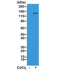 Western blot test of Jurkat cell lysate, untreated or treated with Cobalt Chloride (CoCl2), using recombinant HIF1A antibody at 1:1000. Routinely observed molecular weight: 100~120 kDa.
