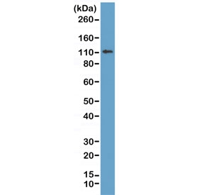 Western blot of human MCF7 lysate using recombinant E-Cadherin antibody at 1:1000. Expected molecular weight: 135 kDa (precursor), 80-120 kDa (mature, depending on gylcosylation level).