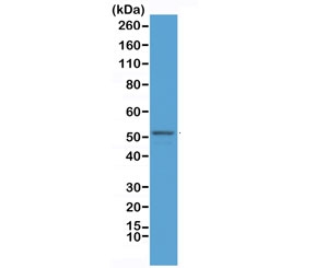 Western blot testing of mouse brain lysate with recombinant GFAP antibody antibody at 1:2500. Predicted molecular weight ~50 kDa.
